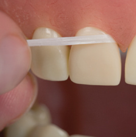 آموزش طرز صحیح استفاده از نخ دندان توسط دکتر زهرا ظهری متخصص جراحی لثه و ایمپلنت و لیزر در استان گیلان و شهر رشت